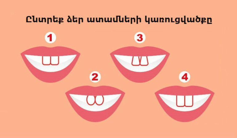 Թեստ․ ատամների կառուցվածքը կարող է շատ բան պատմել ձեր մասին