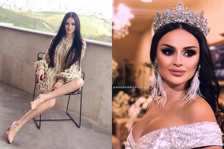 «Դժվար է ապրել` լինելով գեղեցիկ»․ Եվա Բաղդասարյանը` իր համարձակ ոճի, «Հայաստանի գեղեցկուհու» տիտղոսի համար պայքարելու ու նոր հեռուստասերիալում ստացած դերի մասին «Դժվար է ապրել` լինելով գեղեցիկ»․ Եվա Բաղդասարյանը` իր համարձակ ոճի, «Հայաստանի գեղեցկուհու» տիտղոսի համար պայքարելու ու նոր հեռուստասերիալում ստացած դերի մասին