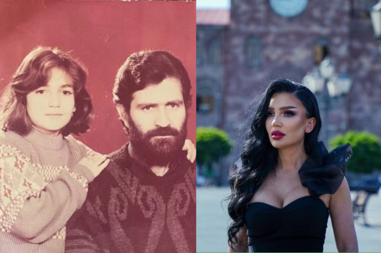 «Ես երկար մազերով տիկնիկ էի ուզում, որ սանրեմ, բայց մերոնք ասացին՝ երկարը թանկ է, կարճ մազերովը գնեցին». Շպռոտ