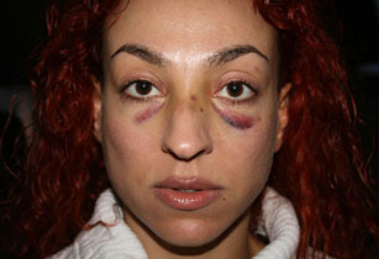 Who Hit Popular Armenian TV Host Juice?