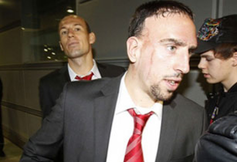 Ribery Quizzed by Police