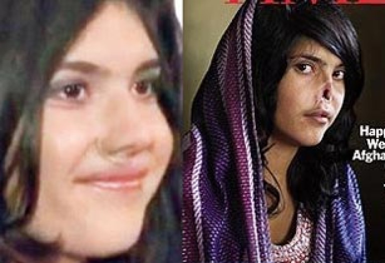 Mutilated Afghan girl Aisha gets new nose