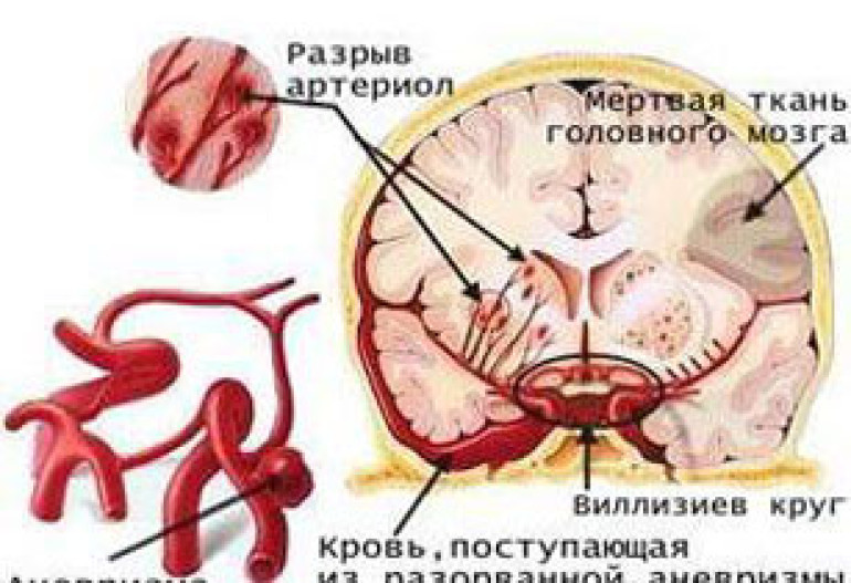 От курения испаряется мозг