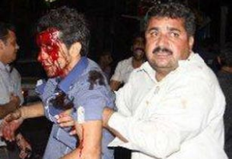 Bombing strikes ceremony in Iran 'killing' dozens 