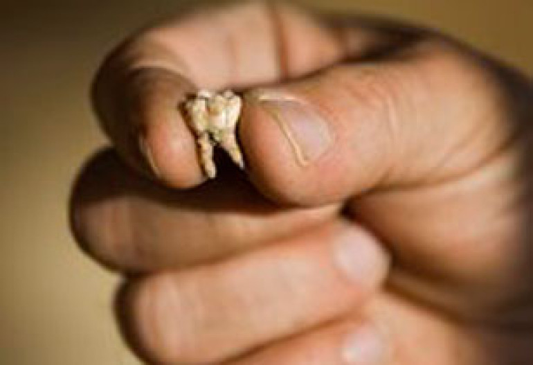 Ancient human remains found in Israel - archaeologists