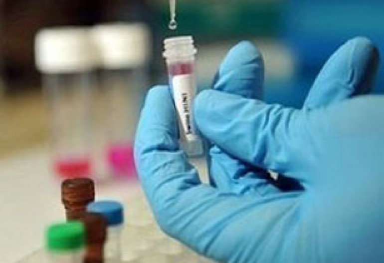 First reported H1N1-related death of 2010