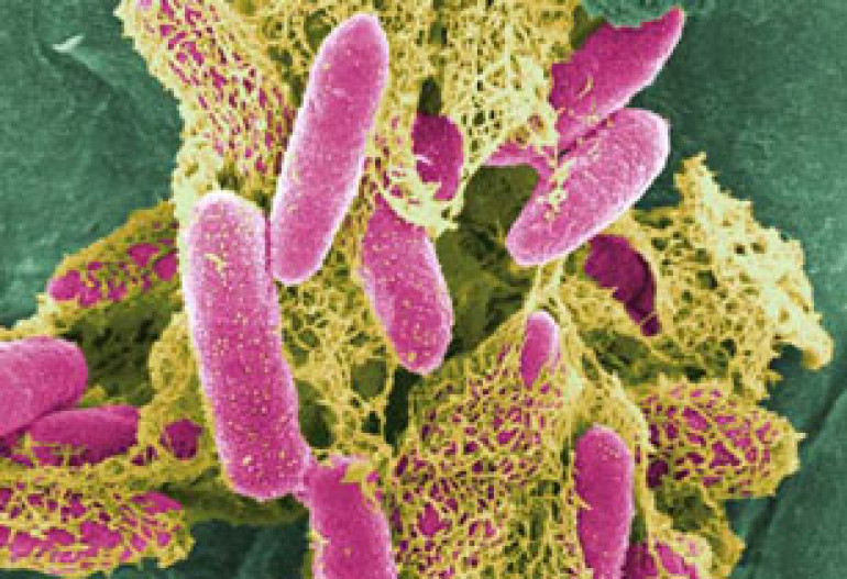  Госинспекция в Чехии обнаружила бактерию E.coli в бутылках с водой