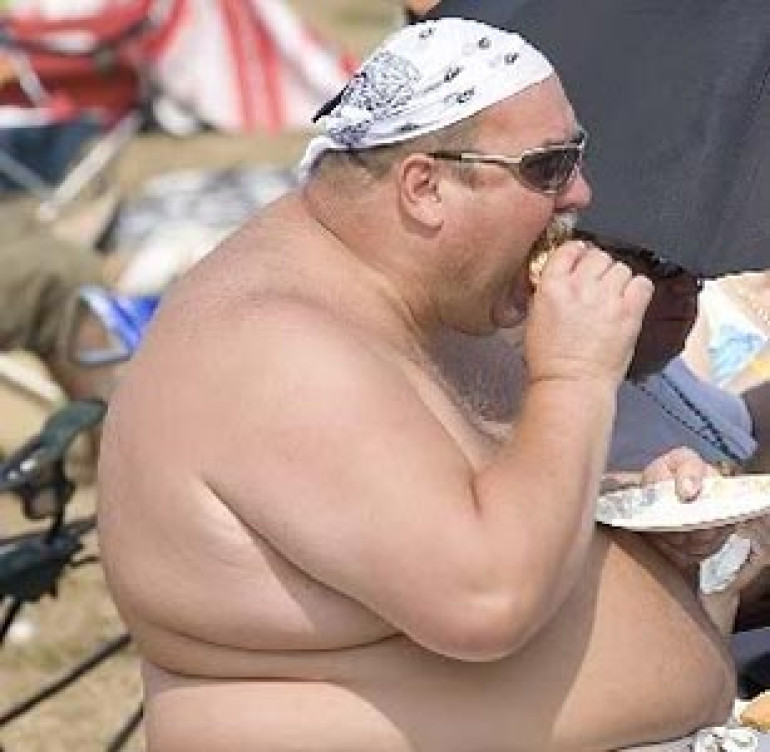 Obesity may cause infertility in males, says doctor