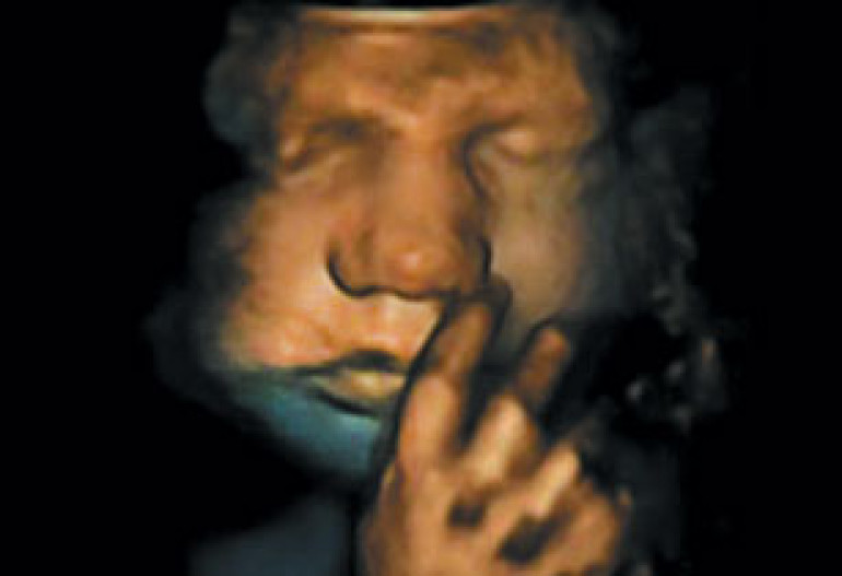 Facial expressions develop before birth, researchers show