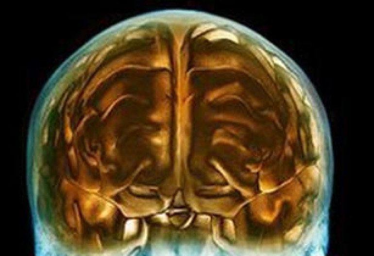 Electric stimulation of brain aids learning process