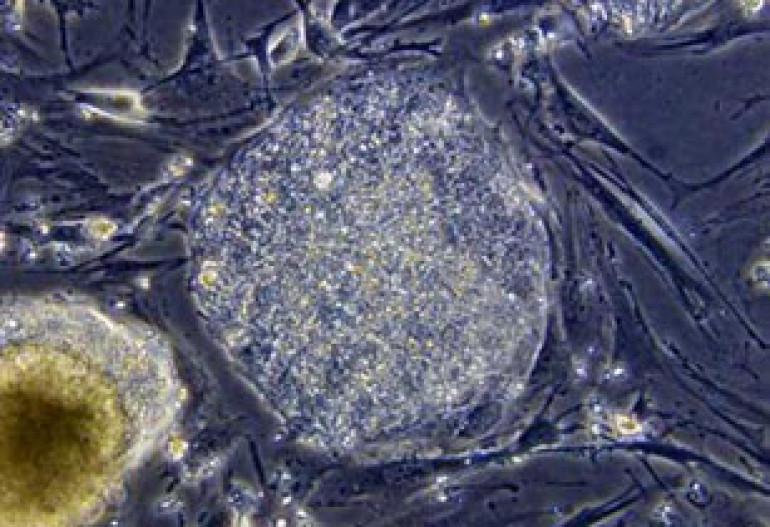 DNA discovery may boost stem cell safety