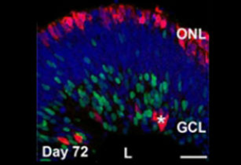 Ученые впервые вырастили сетчатку из клеток крови человека