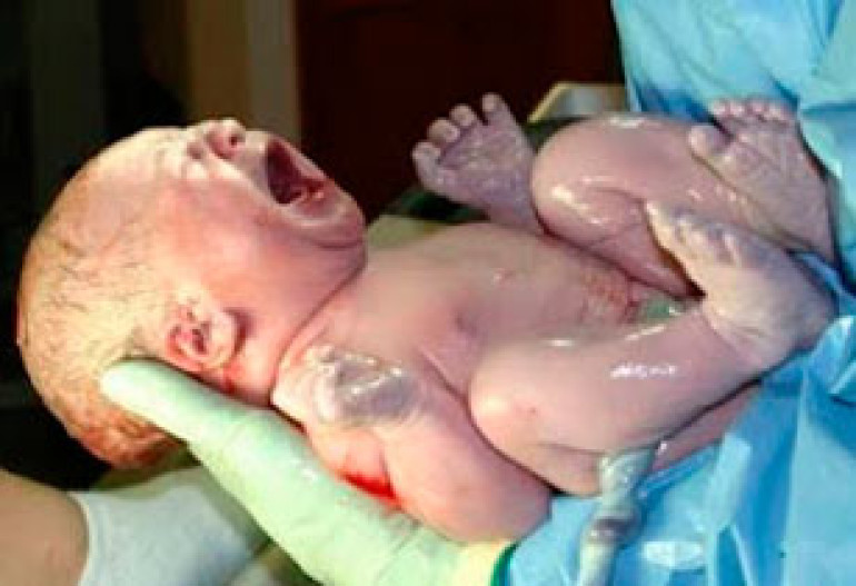 Childbirth longer now than 50 years ago 