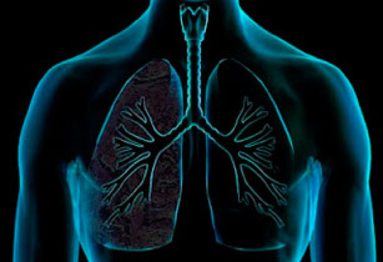 X-rays shed new light on lung function 