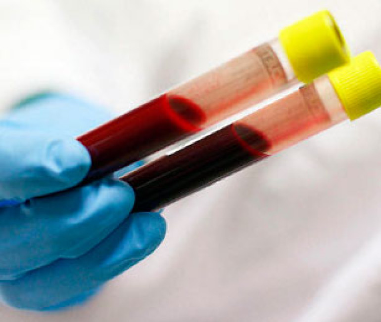Blood test looks promising in diagnosing depression