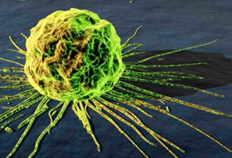 Blood test to identify breast cancer risks