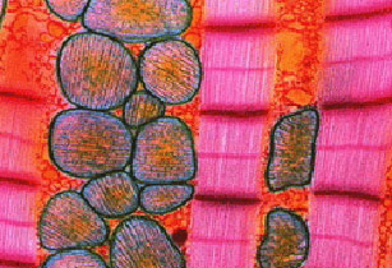 Scientists grow heart muscle from skin cells