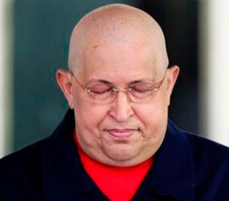 Врачи не уверены, что Чавес доживет до президентских выборов