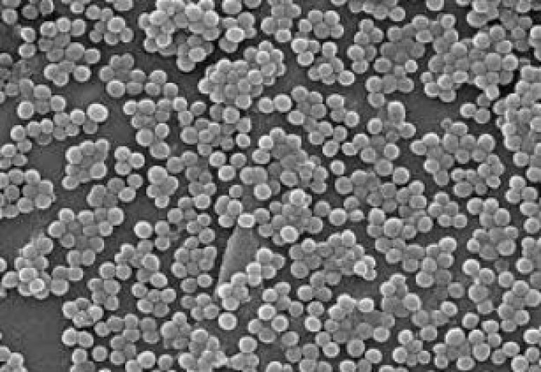 WHO issues untreatable gonorhoea alert