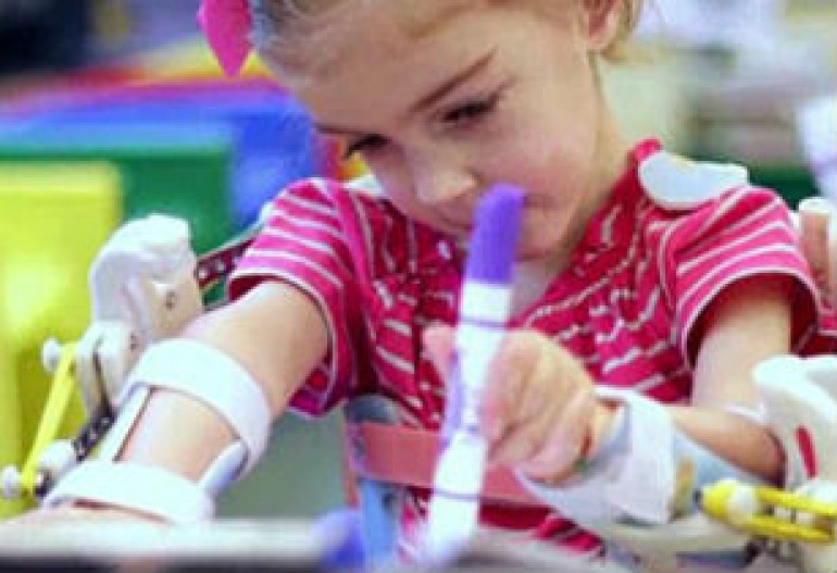 2-летней девочке создали экзоскелет при помощи 3D