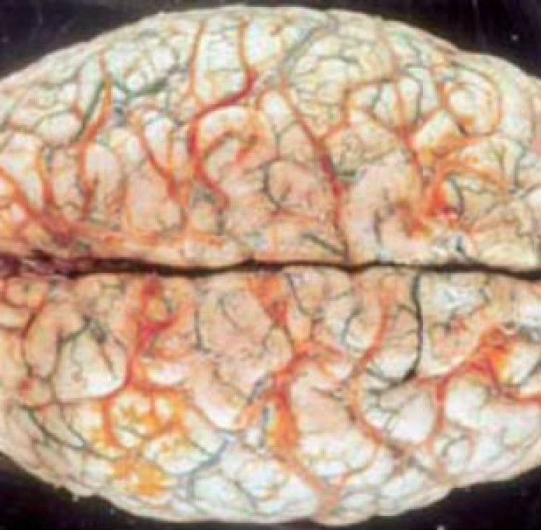  Тест IQ поставили под сомнение 