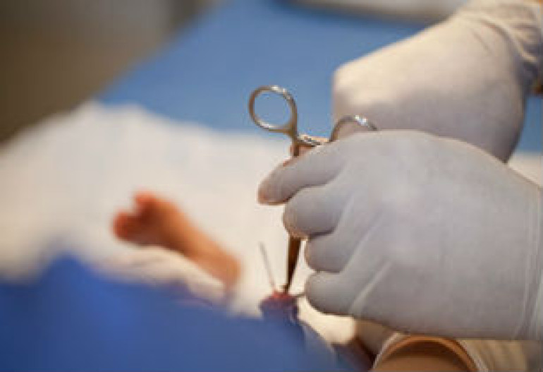 US pediatrics unveil benefits of circumcision