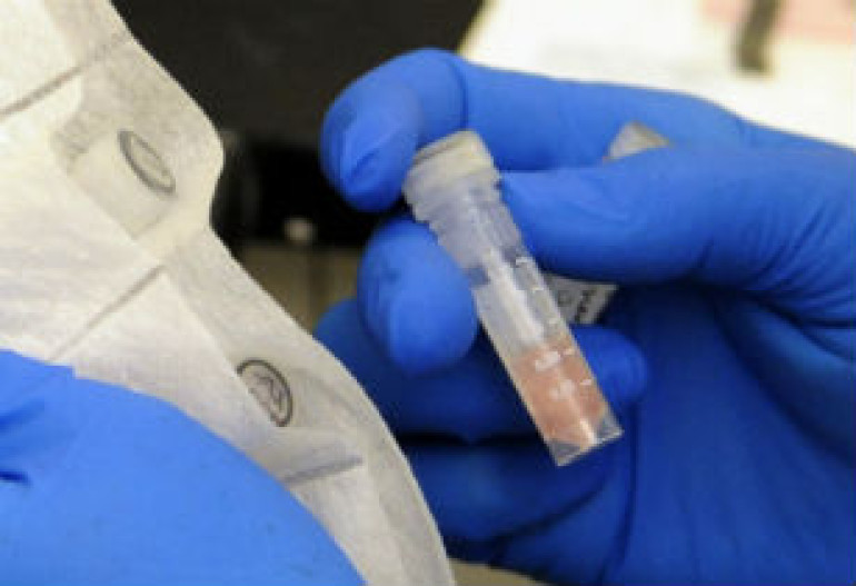 Unprecedented black mold meningitis a challenge