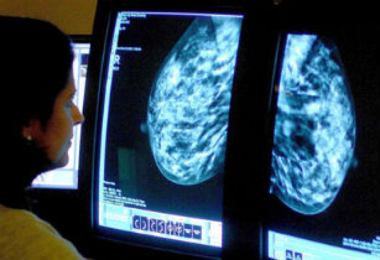 Breast cancer screening contains higher risks than thought