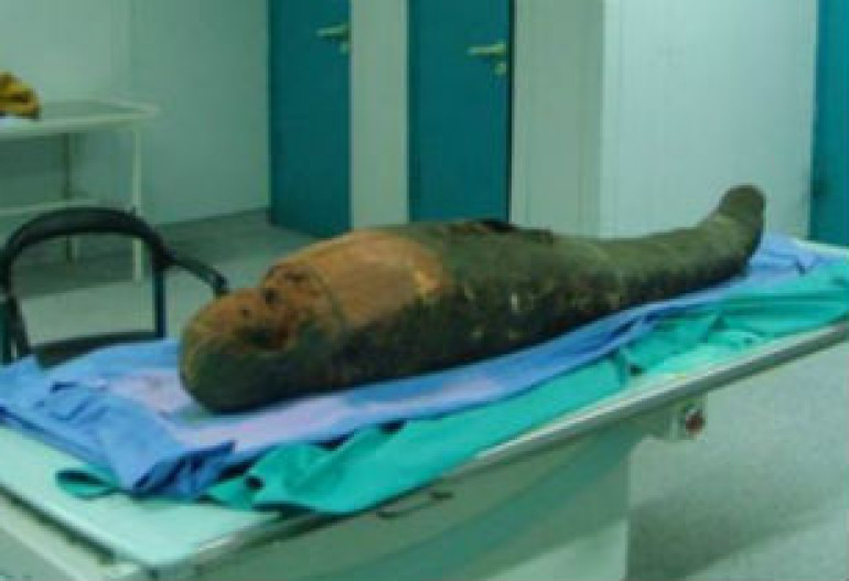 Tool used by ancient Egyptians to remove brains discovered in mummy