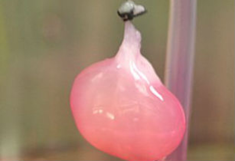 Scientists make 'lab-grown' kidney