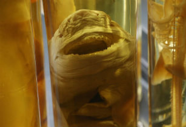 Over a million zoological species preserved in alcohol go on display at Berlin's Natural History Museum