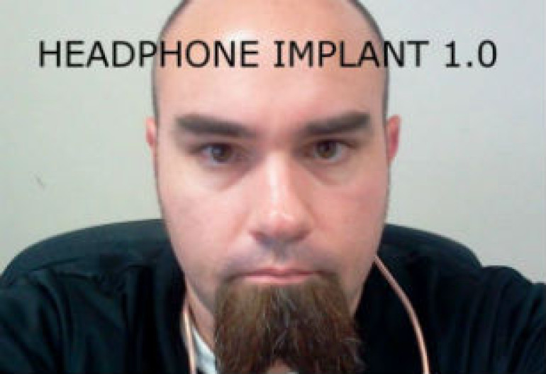 Man has 'speakers' implanted in ears so to listen to music all the time