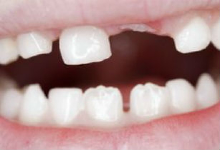 Scientists grow teeth from urine