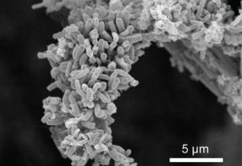 ‘Microbial battery’ could turn wastewater into electricity