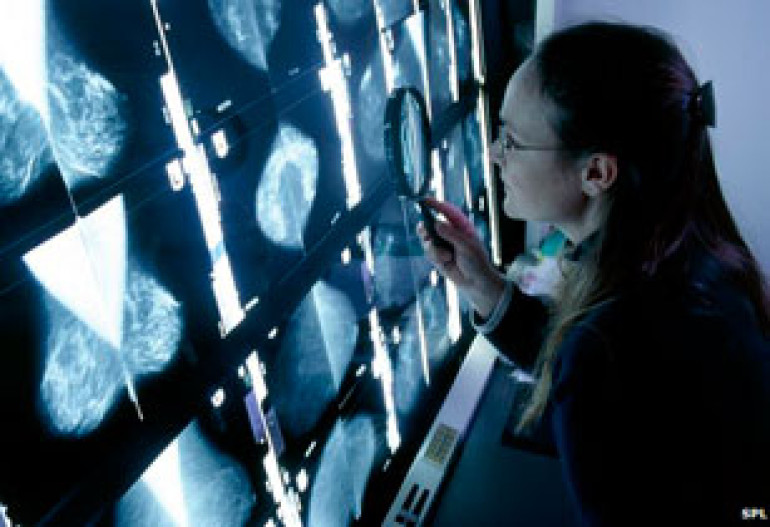 Cancer 'tidal wave' on horizon, warns WHO