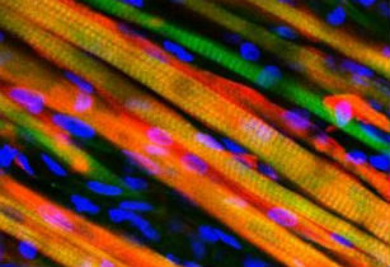Scientists grow self-healing muscle in lab