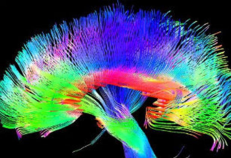 Artists have structurally different brains - study