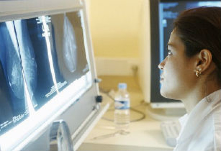 Breast cancer drug hope from leukaemia research