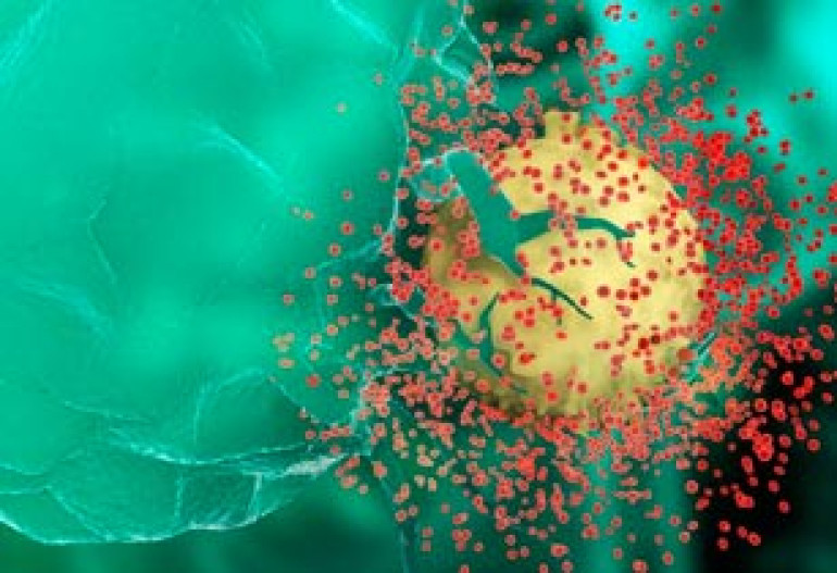 End to Aids by 2030 'is possible'