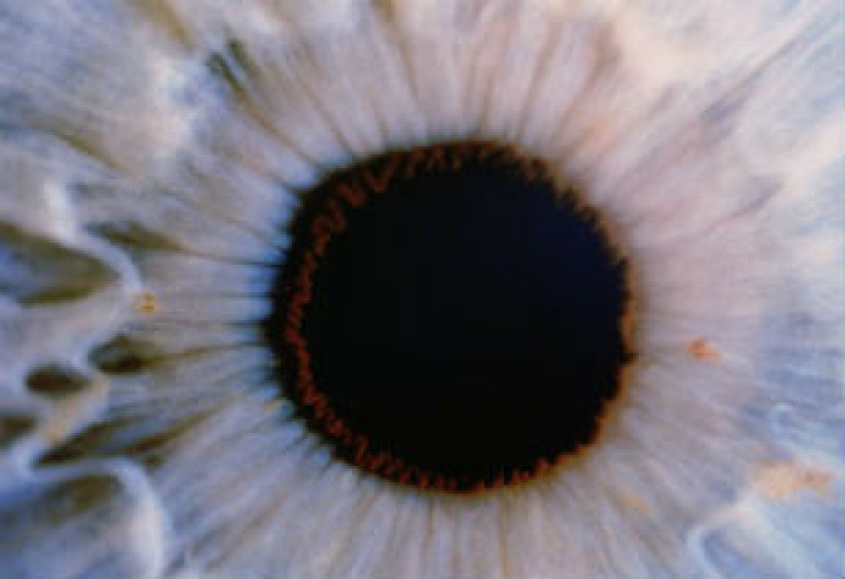 Artificial eye retina to detect particles