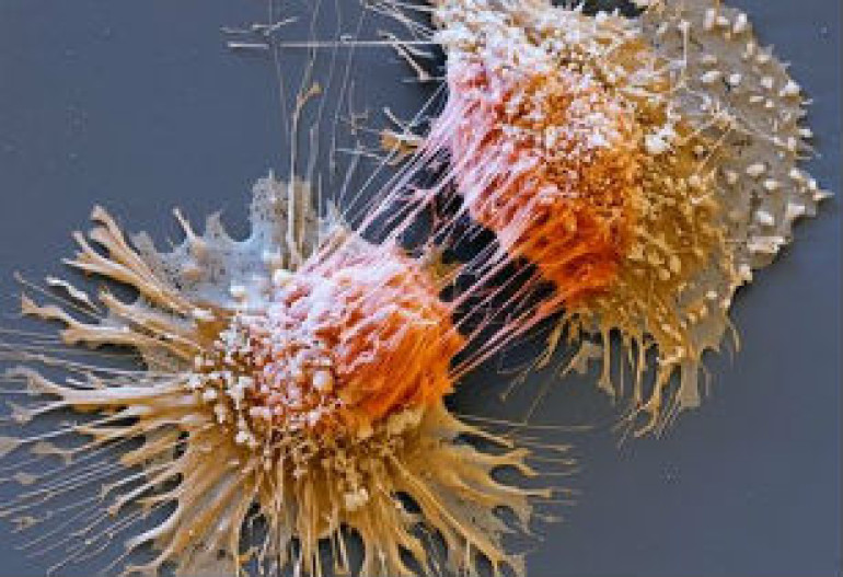 Cancer gene test ‘would save lives’