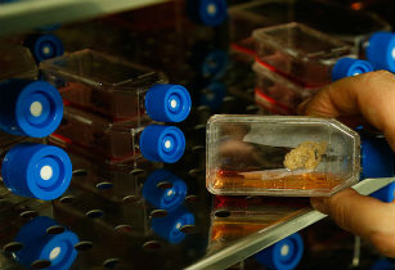 Diabetes breakthrough: Human stem cells altered to produce insulin