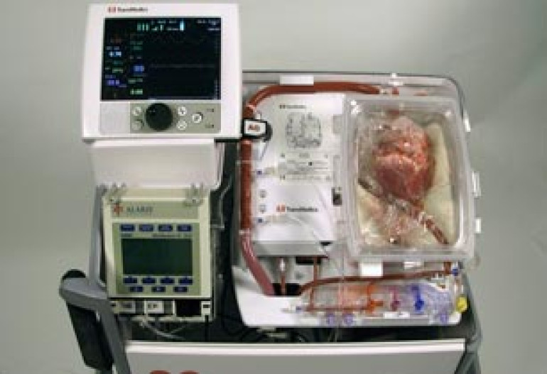 Surgeons transplant heart that had stopped beating