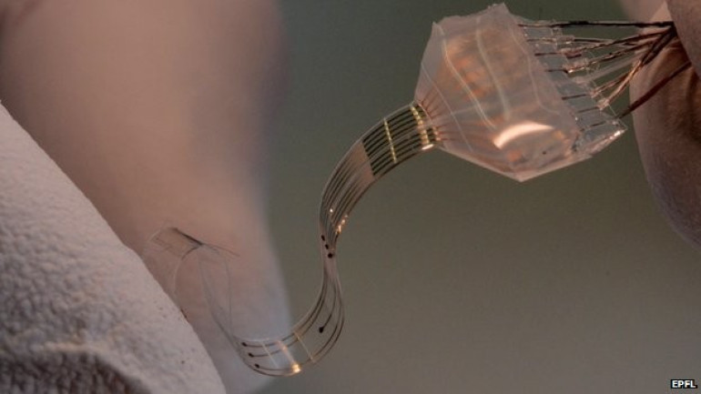 Elastic implant 'restores movement' in paralyzed rats
