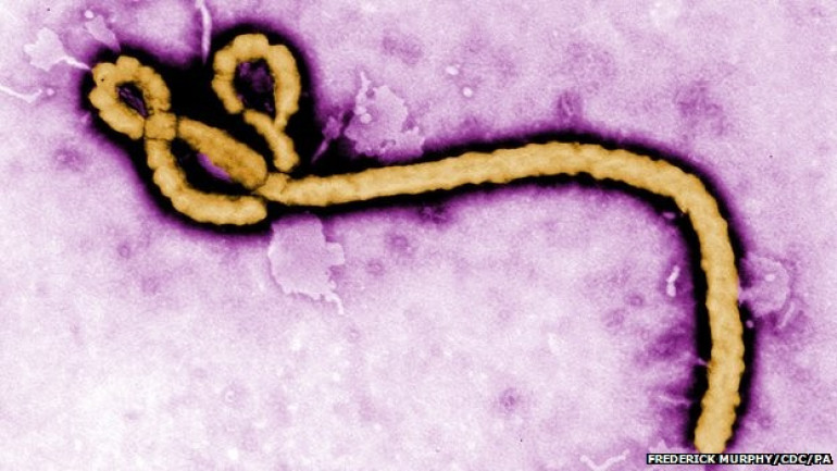 Fifteen-minute Ebola test approved