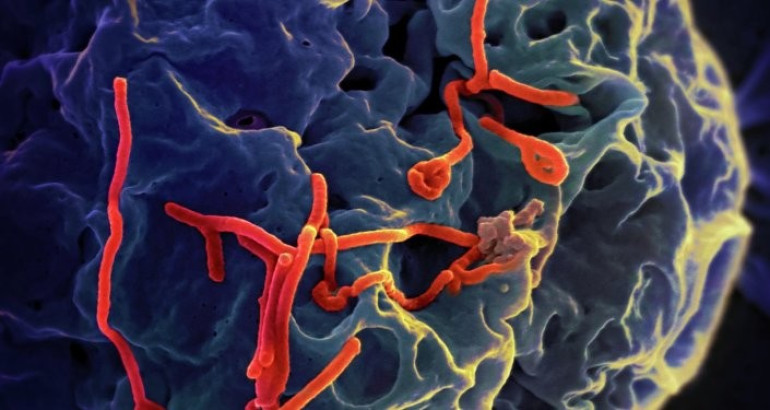 Russian man hospitalized in Kazakhstan shows no Ebola symptoms
