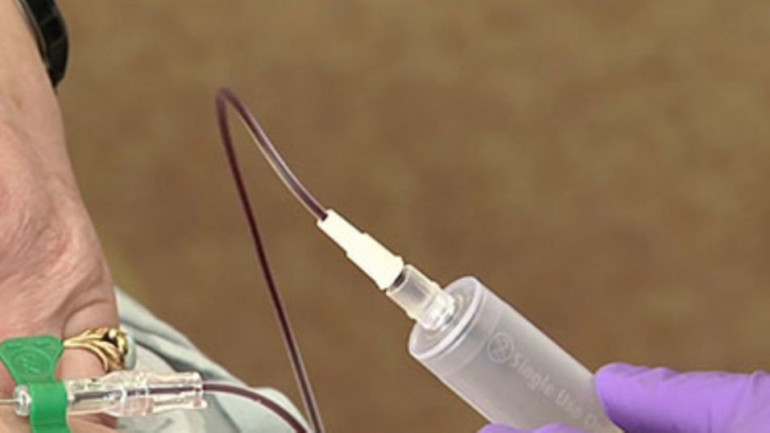 New blood tests, liquid biopsies, may transform cancer care