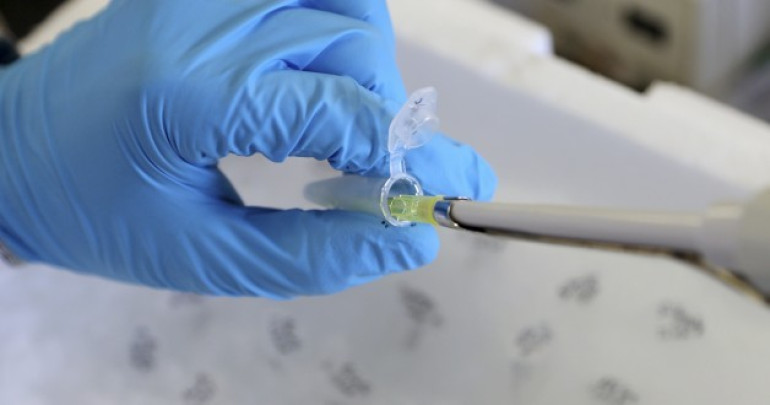 New technology promising rapid cancer testing for the developing world