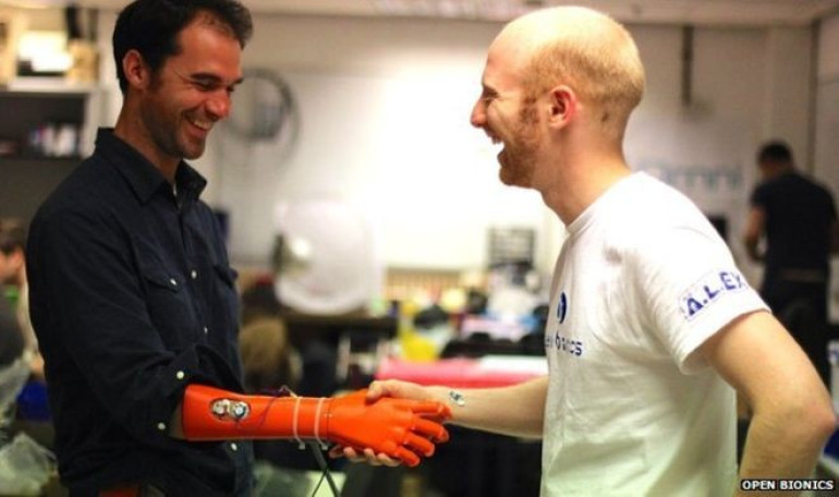 Open Bionics robotic hand for amputees wins Dyson Award