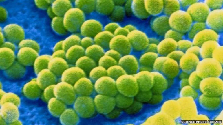 Thousands of microbes found in house dust